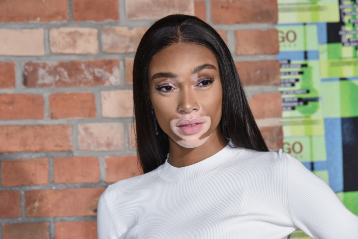 Winnie Harlow