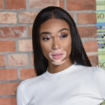 winnie harlow